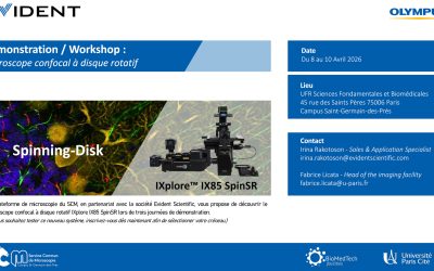 Démonstration « Spinning Disk » : Microscope confocal à disque rotatif